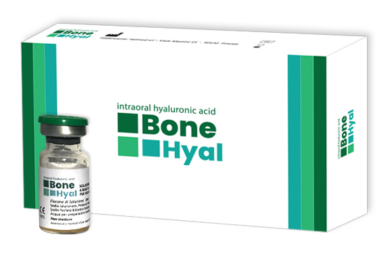 HB-500 - BoneHyal, 5ml, Lieferung inkl. 5 Spritzen Sterile Hyaluronsäure für intraorale Anwendung